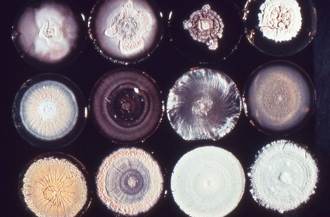 Different "cultures," http://images.google.com/imgres?imgurl=https://farm5.staticflickr.com/4100/4879522198_7381f5da6a_o_d.jpg&imgrefurl=https://www.flickr.com/photos/microbeworld/4879522198&h=1182&w=1800&tbnid=J5m6tKPW8hLN6M:&docid=FeJZ-ZTPMizr-M&hl=en&ei=jwqUVoe2FsLZ-wGI36s4&tbm=isch&ved=0ahUKEwjHuYjxxqLKAhXC7D4KHYjvCgc4ZBAzCB8oHDAc